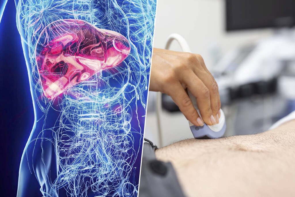 El hígado graso: una epidemia silenciosa que preocupa a la ciencia