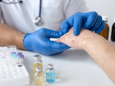 OPS: aumenta casos de Sarampión en las Américas