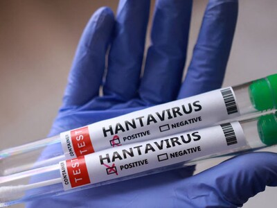 Monitoreo de contactos por hantavirus variante andina