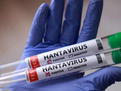 Tres países adquieren tratamiento experimental contra el hantavirus
