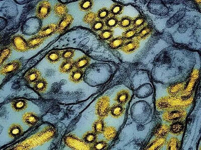 Australia confirma gripe aviar H5 en un págalo pardo
