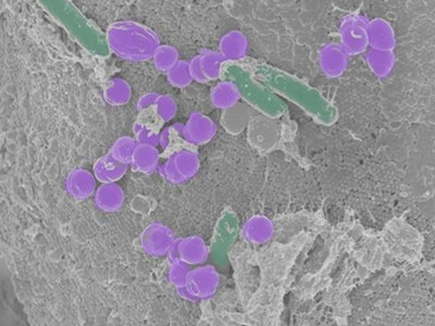 Célula sintética SpudCell completa ciclo vital