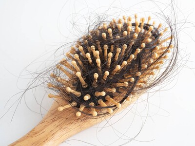 ¿Por qué se produce la alopecia postparto?